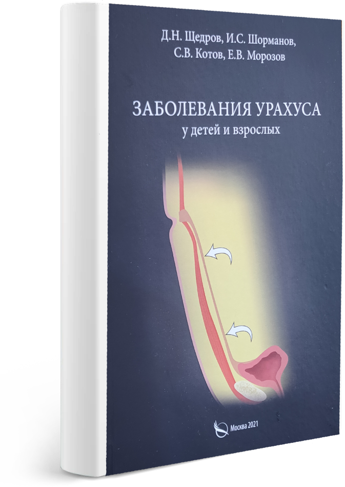 Заболевания урахуса у детей и взрослых
