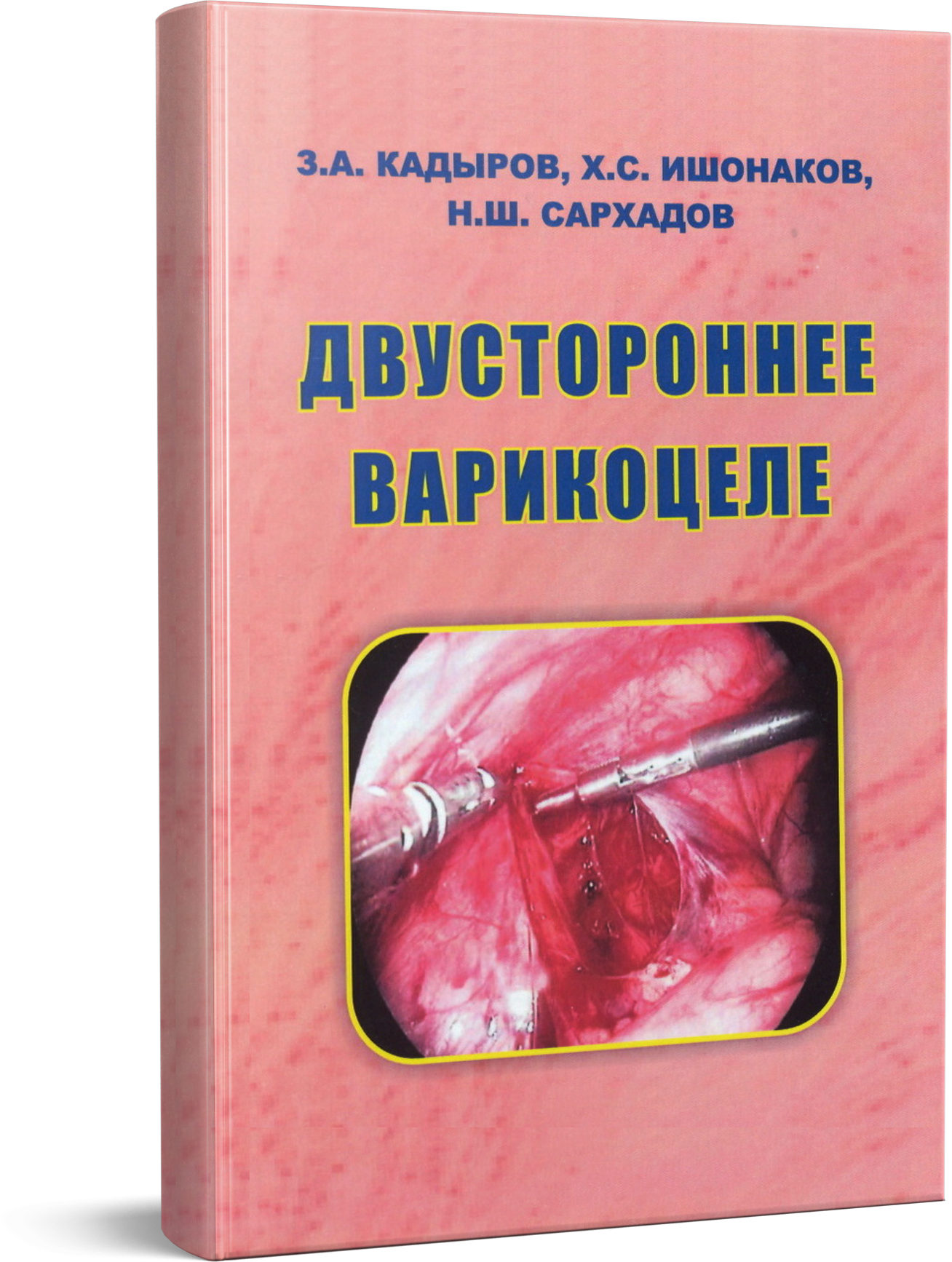 Двустороннее варикоцеле