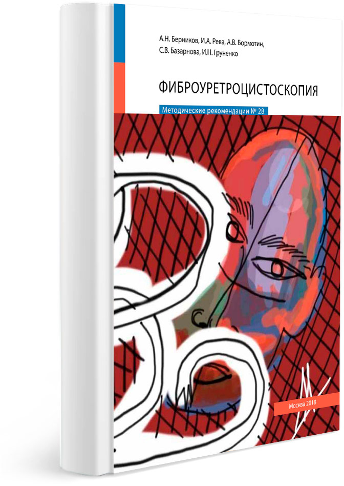 Фиброуретроцистоскопия